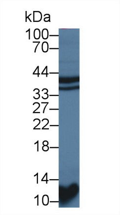 Polyclonal Antibody to Signal Transducing Adaptor Protein 1 (STAP1)