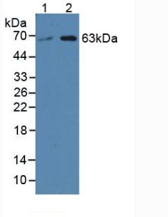 Polyclonal Antibody to Serine Palmitoyltransferase, Long Chain Base Subunit 3 (SPTLC3)