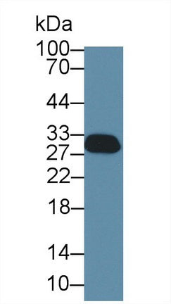 Polyclonal Antibody to Stratifin (SFN)