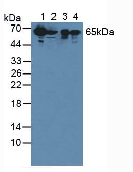 Polyclonal Antibody to Suprabasin (SBSN)