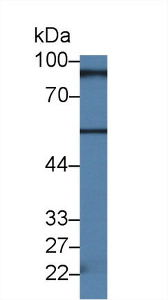 Polyclonal Antibody to RalA Binding Protein 1 (RALBP1)