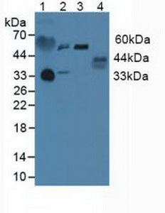Polyclonal Antibody to Prolactin Receptor (PRLR)