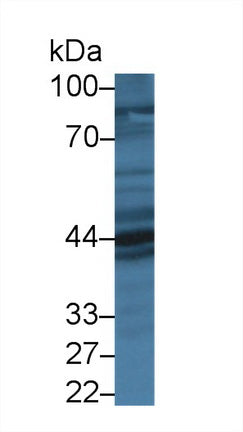 Polyclonal Antibody to Prolactin Receptor (PRLR)