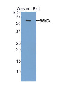 Polyclonal Antibody to Periplakin (PPL)
