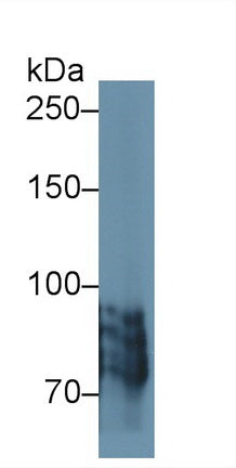 Polyclonal Antibody to Periostin (POSTN)