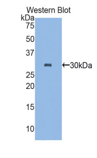 Polyclonal Antibody to Plastin 3 (PLS3)