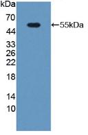 Polyclonal Antibody to Phosphoglycolate Phosphatase (PGP)