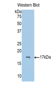 Polyclonal Antibody to Polybromo 1 (PBRM1)