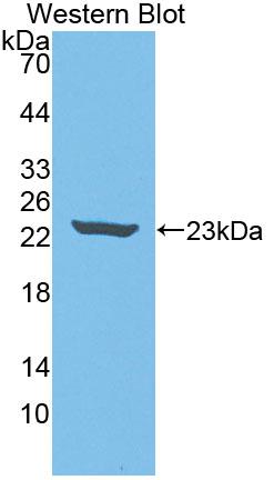 Polyclonal Antibody to Neuropathy Target Esterase (NTE)