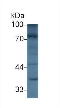 Polyclonal Antibody to Nexilin (NEXN)