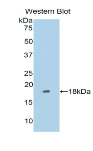 Polyclonal Antibody to Leucine Rich Repeat In FLII Interacting Protein 1 (LRRFIP1)