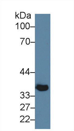 Polyclonal Antibody to Klotho Beta (KLb)
