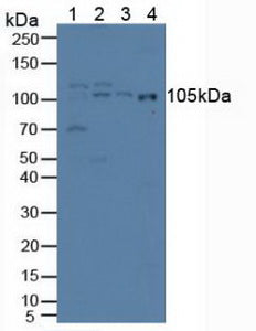Polyclonal Antibody to Iron Responsive Element Binding Protein 2 (IREB2)