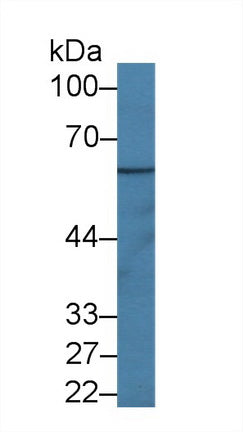 Polyclonal Antibody to Interleukin 1 Receptor Accessory Protein (IL1RAP)