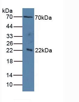Polyclonal Antibody to Interleukin 1 Receptor Accessory Protein (IL1RAP)