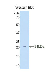 Polyclonal Antibody to Interleukin 18 Binding Protein (IL18BP)