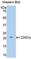 Polyclonal Antibody to Interleukin 18 Binding Protein (IL18BP)