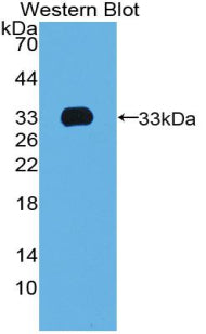 Polyclonal Antibody to T-Box Protein 4 (TBX4)