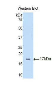 Polyclonal Antibody to T-Box Protein 3 (TBX3)