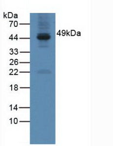 Polyclonal Antibody to Galactose-3-O-Sulfotransferase 1 (GAL3ST1)