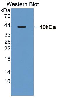 Polyclonal Antibody to Fragile X Mental Retardation 1 (FMR1)