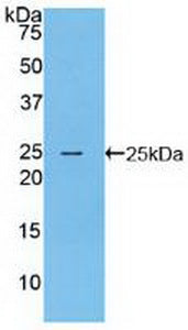 Polyclonal Antibody to Filaggrin (FLG)