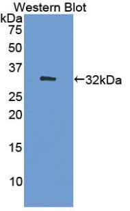 Polyclonal Antibody to DNA Methyltransferase 1 (DNMT1)