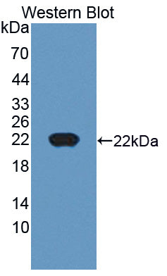 Polyclonal Antibody to Cancer/Testis Antigen 1B (CTAG1B)