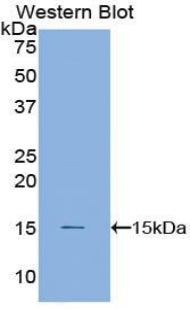 Polyclonal Antibody to Cystatin B (CSTB)