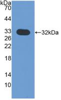 Polyclonal Antibody to Chitinase 1 (CHIT1)