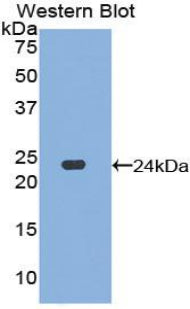 Polyclonal Antibody to Dishevelled, Dsh Homolog 1 (DVL1)