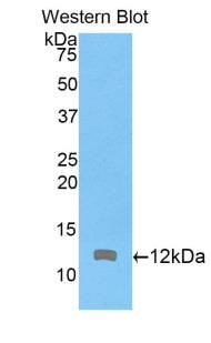 Polyclonal Antibody to Actin Related Protein 2/3 Complex Subunit 4 (ARPC4)