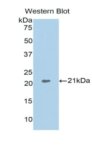 Polyclonal Antibody to Actin Related Protein 2/3 Complex Subunit 4 (ARPC4)