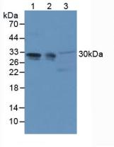 Polyclonal Antibody to Acidic Nuclear Phosphoprotein 32 Family, Member A (ANP32A)
