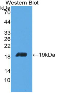 Polyclonal Antibody to Aconitase 1 (ACO1)