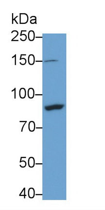 Polyclonal Antibody to Inhibitor Of Kappa-Light Polypeptide Gene Enhancer In B-Cells Kinase Beta (IkBKb)