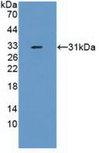 Polyclonal Antibody to F-Box And WD Repeat Domain Containing Protein 7 (FBXW7)