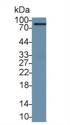 Polyclonal Antibody to V-Set Domain Containing T-Cell Activation Inhibitor 1 (VTCN1)