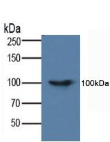 Polyclonal Antibody to Fas Associating Death Domain Containing Protein (FADD)