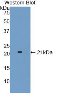 Polyclonal Antibody to A Disintegrin And Metalloproteinase With Thrombospondin 2 (ADAMTS2)