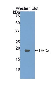 Polyclonal Antibody to Gastrokine 3 (GKN3)