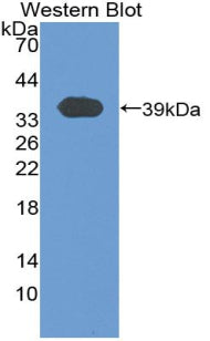 Polyclonal Antibody to T-Kininogen 1 (KNT1)