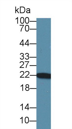 Polyclonal Antibody to Parkinson Disease Protein 7 (PARK7)