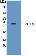 Polyclonal Antibody to GM2 Ganglioside Activator (GM2A)