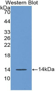 Polyclonal Antibody to Angiogenic Factor With G Patch And FHA Domains 1 (AGGF1)