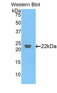 Polyclonal Antibody to C-Type Lectin Domain Family 3, Member B (CLEC3B)