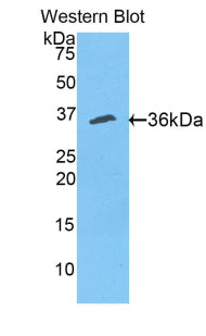 Polyclonal Antibody to CutC Copper Transporter (CUTC)