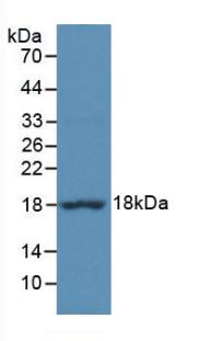 Polyclonal Antibody to Eukaryotic Translation Initiation Factor 4E Binding Protein 1 (EIF4EBP1)