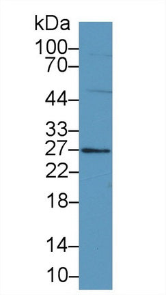 Polyclonal Antibody to Family With Sequence Similarity 3, Member B (FAM3B)