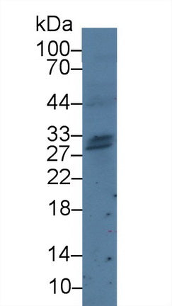 Polyclonal Antibody to Granzyme H (GZMH)